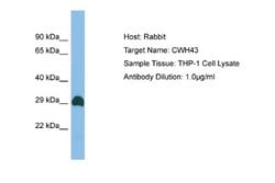 CWH43 Rabbit anti-Human, Polyclonal, Novus Biologicals 0.1 mL | Buy Online | Novus Biologicals | Fisher Scientific